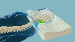 Sale CENTA-STAR Nackenstützkissen NECKPROTECT